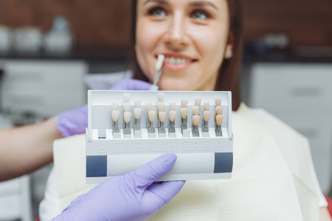 tooth-color-samples-1400px