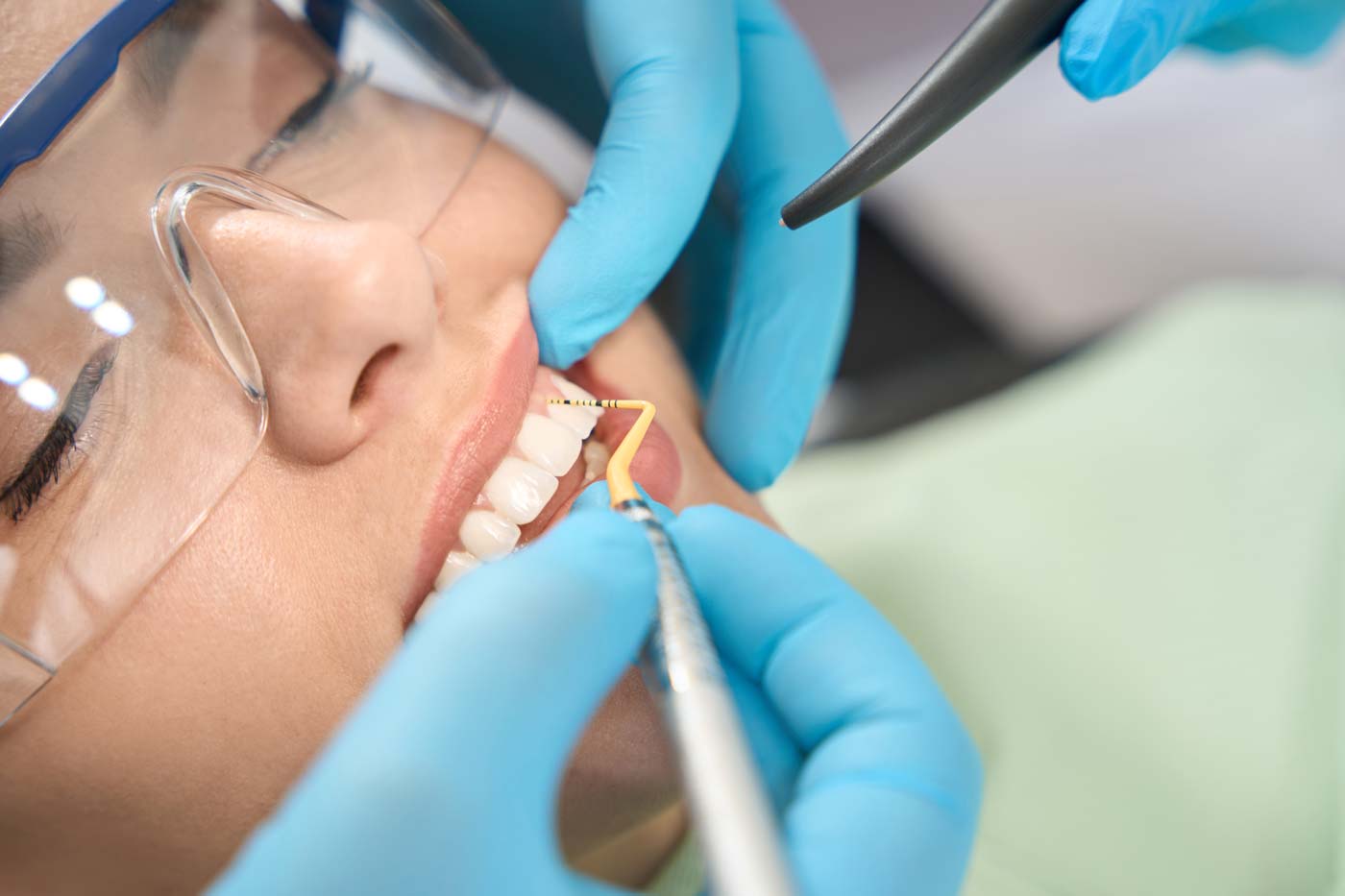 teeth-cleaning-1400px